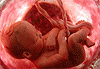 Descarga: En el vientre materno